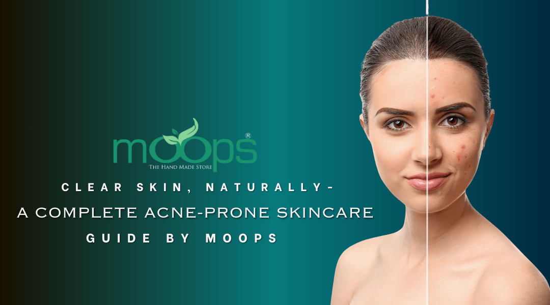 Clear Skin, Naturally – A Complete Acne-Prone Skincare Guide by Moops