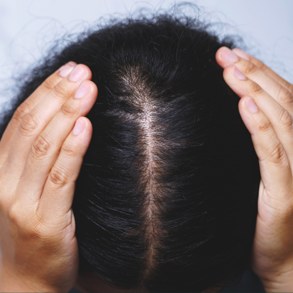 BALANCE SCALP OIL 